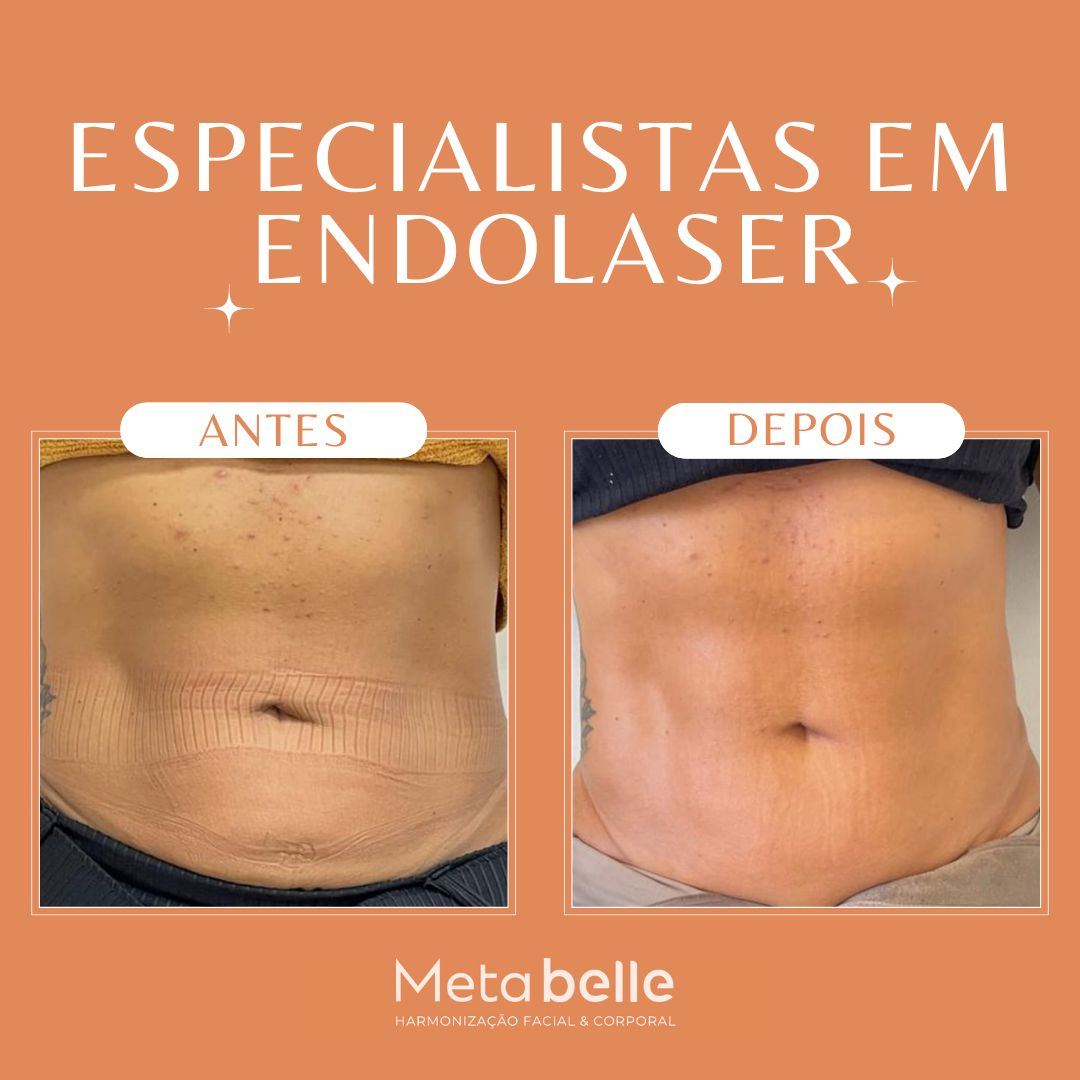 Imagem do WhatsApp de 2024-03-25 à(s) 15.19.23_24f1fc61