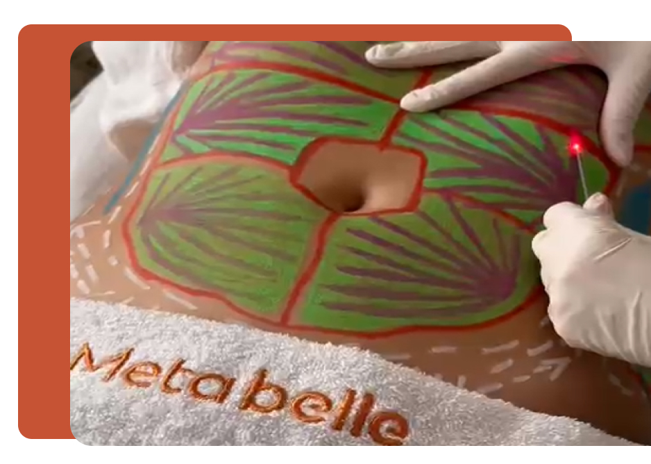 Resultados - MetaBelle Banner - Clinica de estética