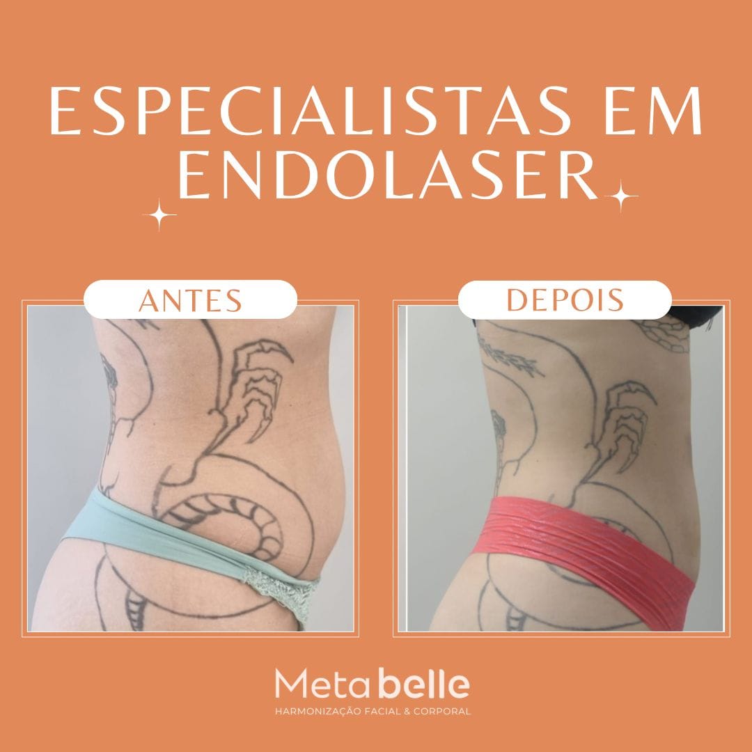 Resultados - MetaBelle Banner - Clinica de estética
