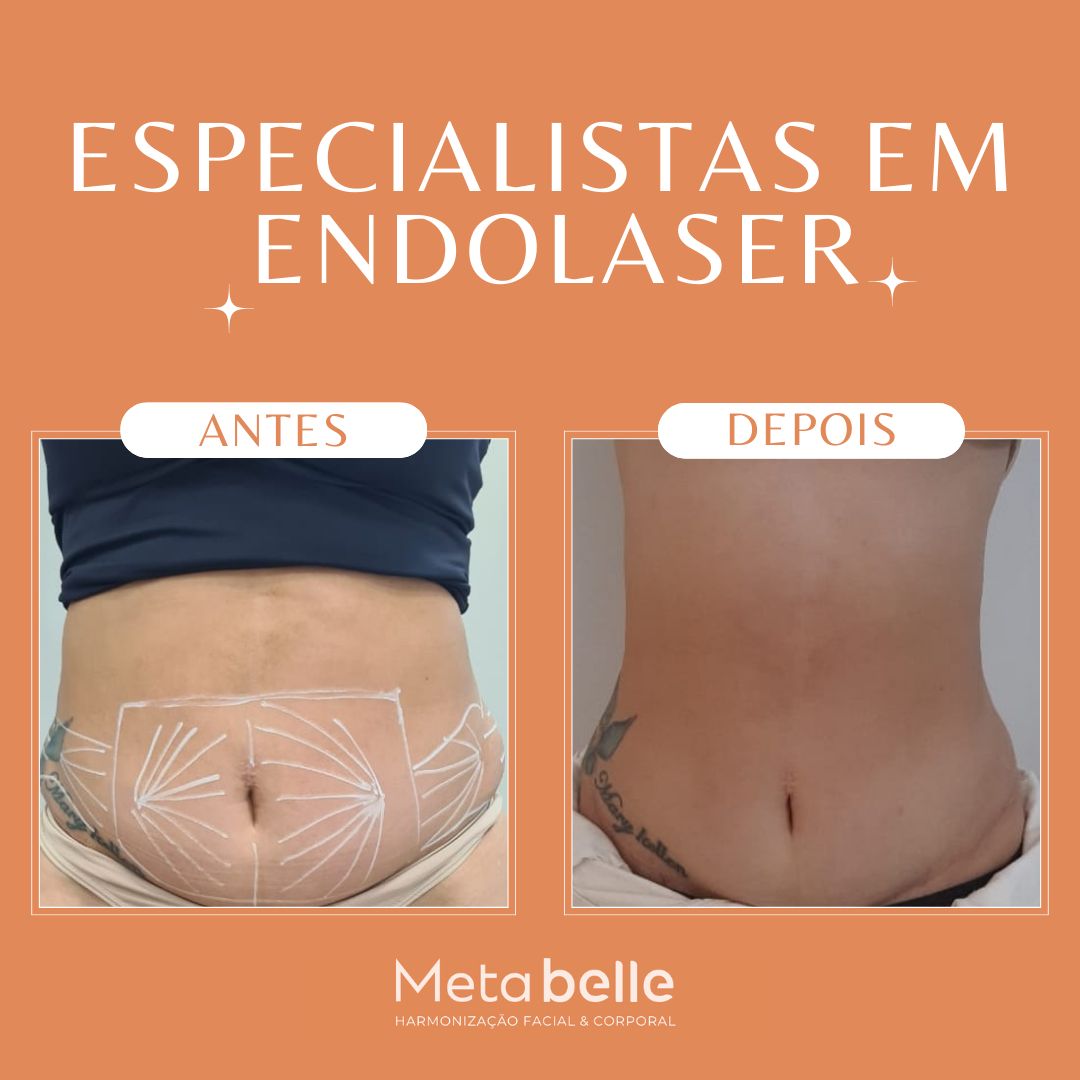 Resultados - MetaBelle Banner - Clinica de estética