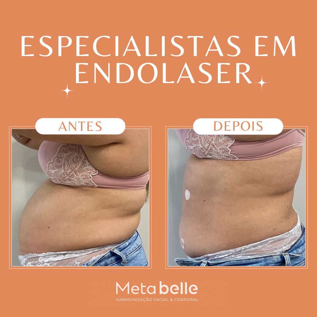 Resultados - MetaBelle Banner - Clinica de estética