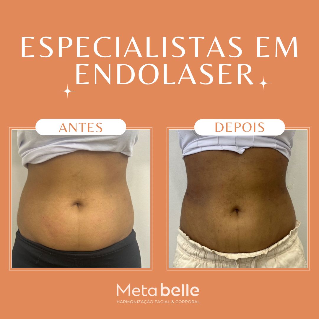 Resultados - MetaBelle Banner - Clinica de estética