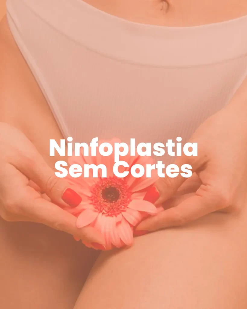 Ninfoplastia Sem cortes - MetaBelle - Clinica de estética