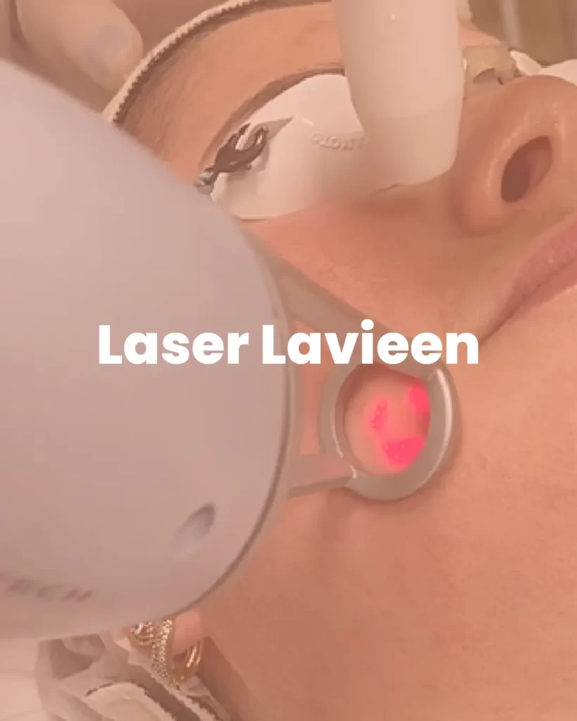 Laser Lavieen -MetaBelle - Clinica de estética